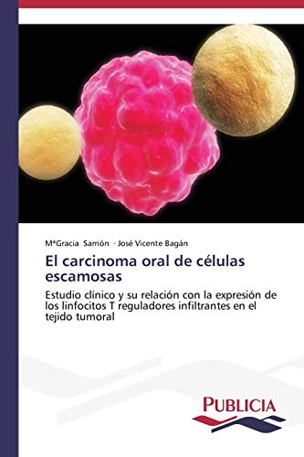 El carcinoma oral de células escamosas: Estudio clínico y su relación con la expresión de los linfocitos T reguladores infiltrantes en el tejido tumoral