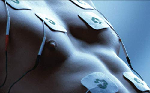 Tesmed MAX 830 con 20 electrodos electrodos electroestimulador muscular profesional: máxima potencia, abdominales, fortalecimiento muscular, contraturas, inestesismo, masajes tens