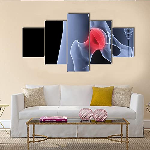 Cuadro Moderno Lienzo Decoración Pelvis masculina bajo los rayos X Cuadro de Pared impresión artística fotografía Imagen gráfica Pintura Estirado Enmarcado