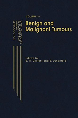 GnRH Analogues in Reproduction and Gynecology: Volume II GnRH Analogues in Cancer and Human Reproduction (English Edition)