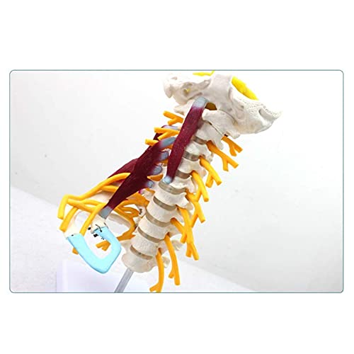 Modelo de vértebras cervicales - Modelo de vértebras cervicales humanas con nervios, tallo cerebral, hueso occipital, axila, vértebras cervicales torácicas - Modelo de enseñanza médica de hueso esquel