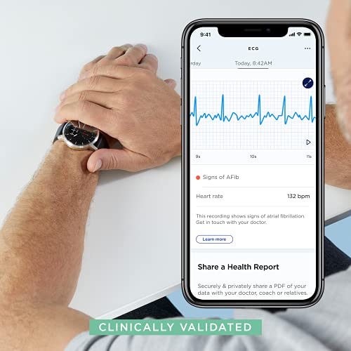 Withings ScanWatch - Reloj inteligente híbrido con ECG, tensiómetro y oxímetro, 38 mm, Blanco