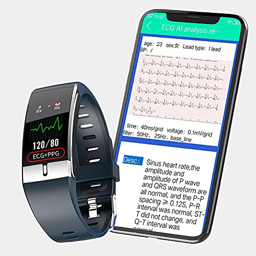 ECG Smartwatch con Temperatura Corporal, Impermeable IP68 Reloj Inteligente Medidor de Frecuencia Cardíaca Medidor de Presión del Tiempo Contador de Calorías Podómetro para Hombre Mujer (Azul)