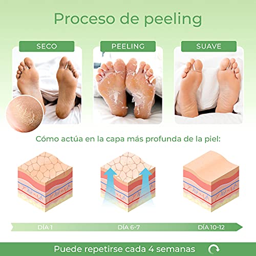 Mascarilla Exfoliante Pies de Fresa probada dermatológicamente - calcetines exfoliantes de pies para callos y peeling pies de Plantifique - Eficaz para callos, piel muerta y seca - 2 pares