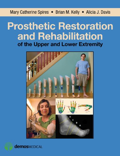 Prosthetic Restoration and Rehabilitation of the Upper and Lower Extremity (English Edition)
