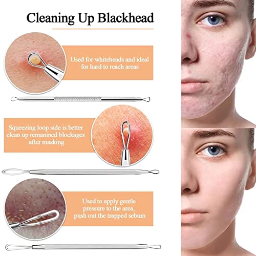 6 piezas Kit Blackhead Remover,Quita Espinillas Negros Comedones Herramientas,Extractor de Acné Eliminación Puntos Negros para la Piel Facial,Puntos Negros Aguja Extractor