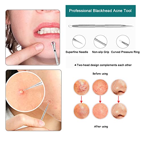 6 piezas Kit Blackhead Remover,Quita Espinillas Negros Comedones Herramientas,Extractor de Acné Eliminación Puntos Negros para la Piel Facial,Puntos Negros Aguja Extractor