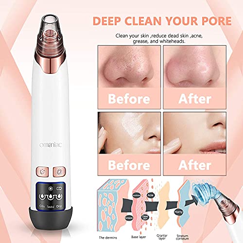 OMANIAC Succionador de Puntos Negros Limpiador de Poros Limpiador Facial Blackhead Remover Recargable via USB 5 Cabezales Pulidores Faciales y 4 herramientas para eliminar el acné