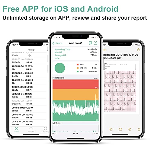 ViATOM Monitor de Ritmo Cardíaco Cinturón Torácico, Bluetooth ANT+, Monitor de ECG con Cojinetes de Ejercicio, Se Puede Usar sin Cables, Registrador de Frecuencia Cardíaca con la Alarma de Vibración