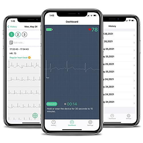 Wellue DuoEK-S Monitor Personal de ECG, Monitores Cardíacos Portátiles Inalámbricos Bluetooth con Pantalla OLED de 0,96 Pulgadas, Monitoreo de 30s-5min, APP para iOS y Android