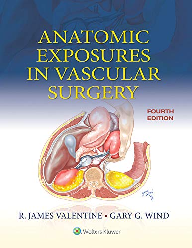 Anatomic Exposures in Vascular Surgery (English Edition)