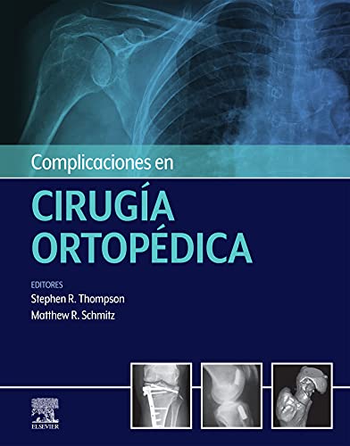 Complicaciones en cirugía ortopédica: Medicina deportiva