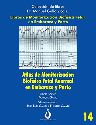 Atlas de Monitorizacion Biofisica Fetal Anormal en el Embarazo y Parto: 14 (Coleccion de libros Dr. Manuel Gallo y cols)